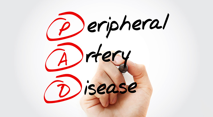 News What is Peripheral Artery Disease, PAD, What is PAD