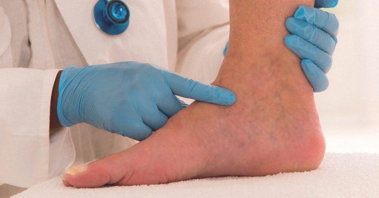 Edema Examination