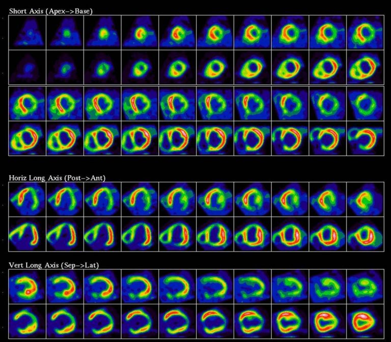 pet scan viability